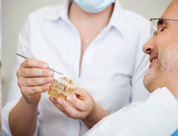 dental implants